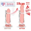 Pro Extender Device – Advanced Adjustable Length Support System for Men