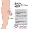 Pro Extender Device – Advanced Adjustable Length Support System for Men